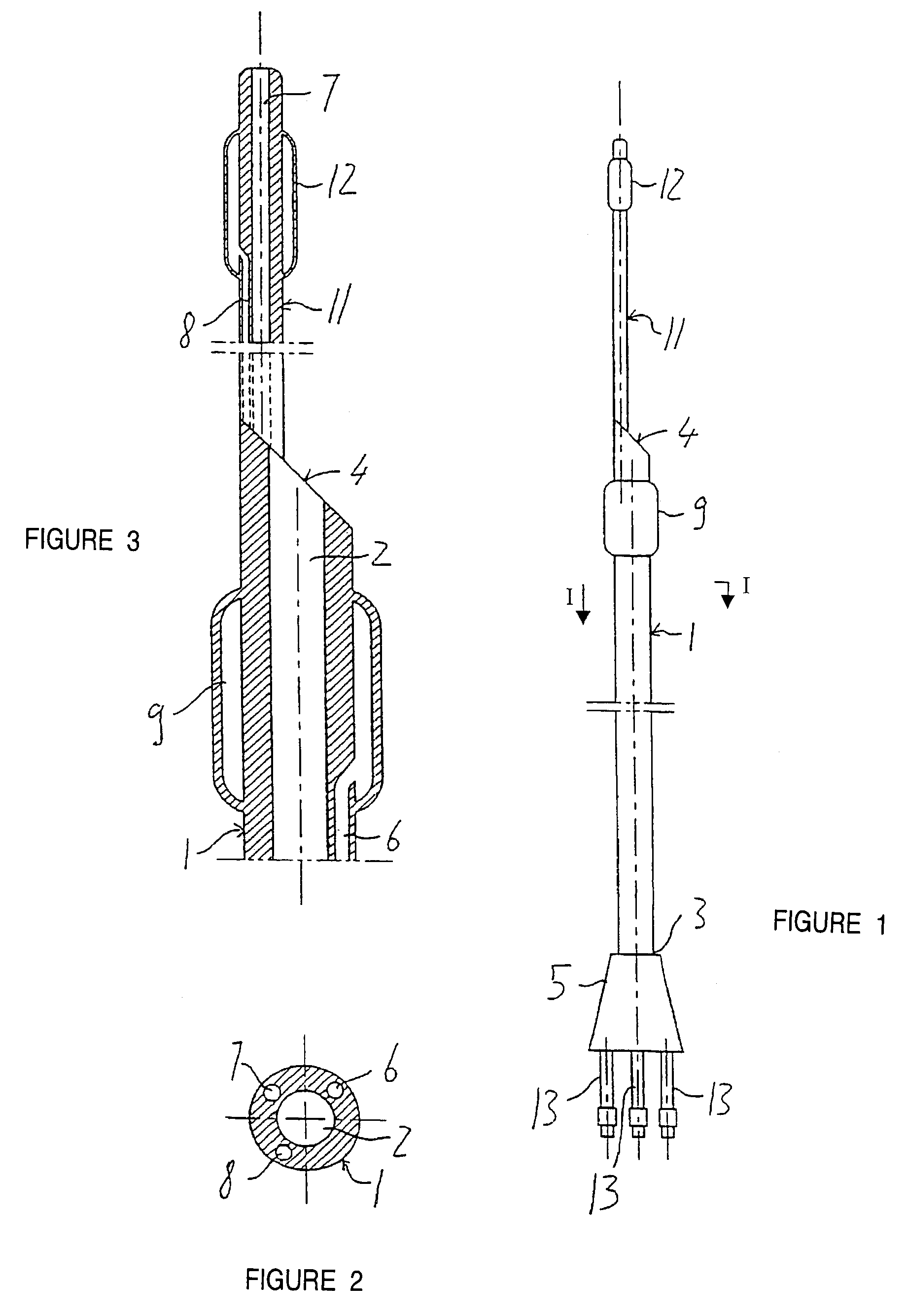 Endovascular system for the treatment of stenoses of the carotid and catheter for this system