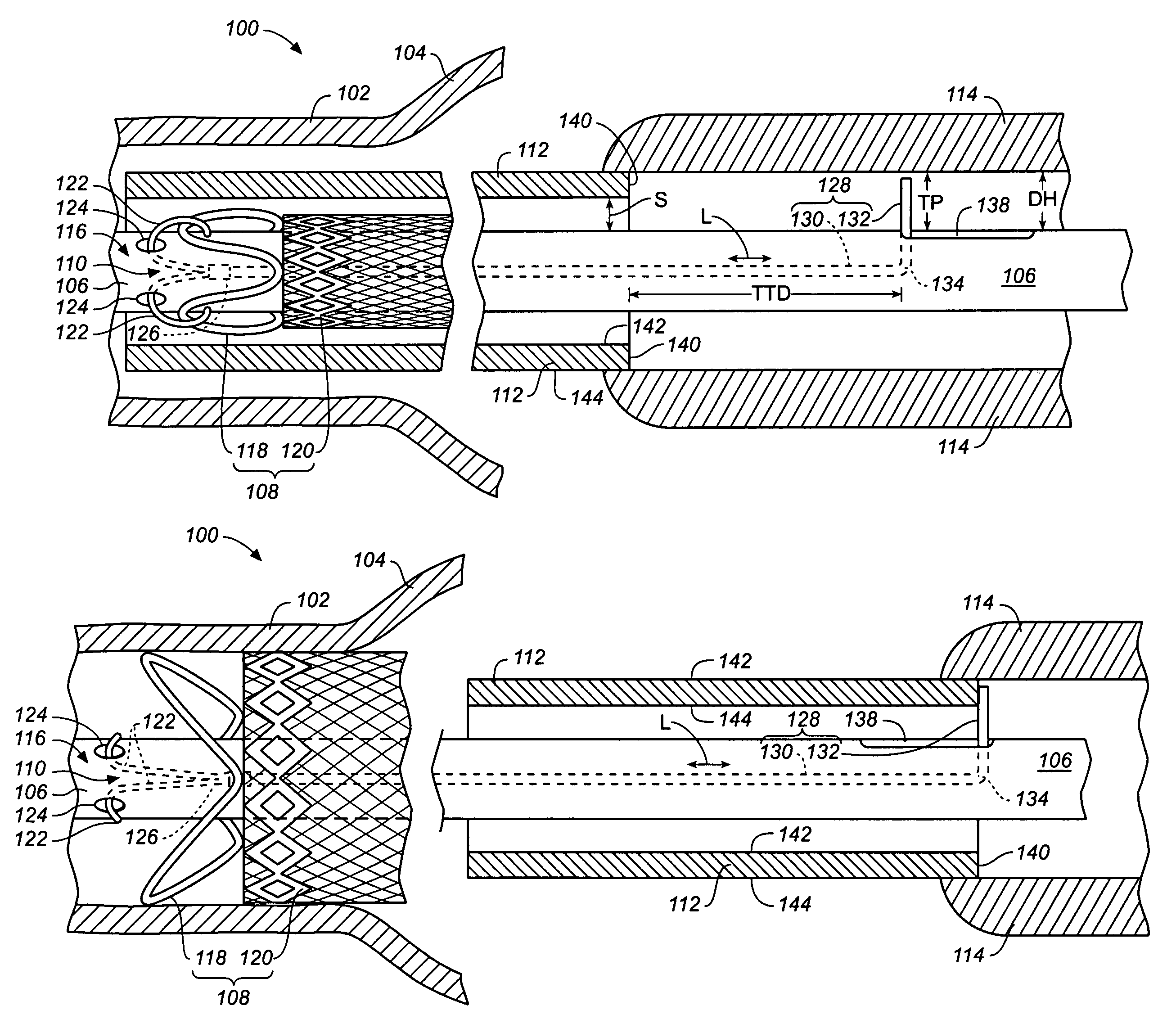 Stent-graft delivery system