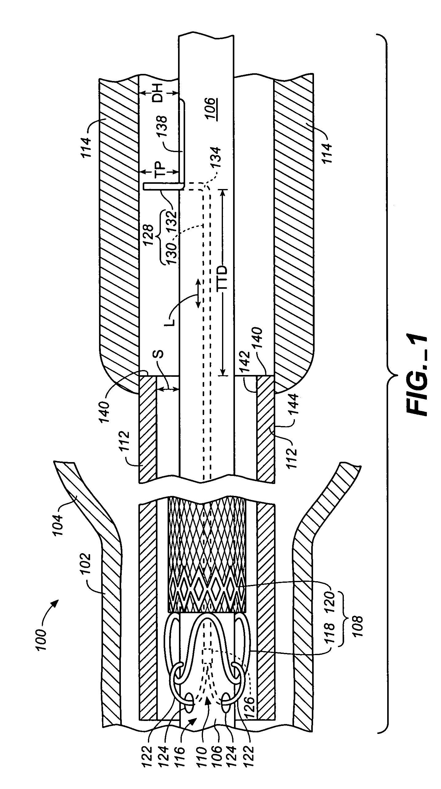 Stent-graft delivery system