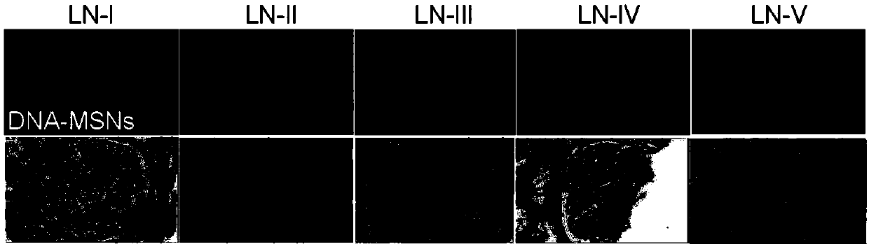 Application of DNA immunosorbent in preparation of ds-DNA antibody detection reagents