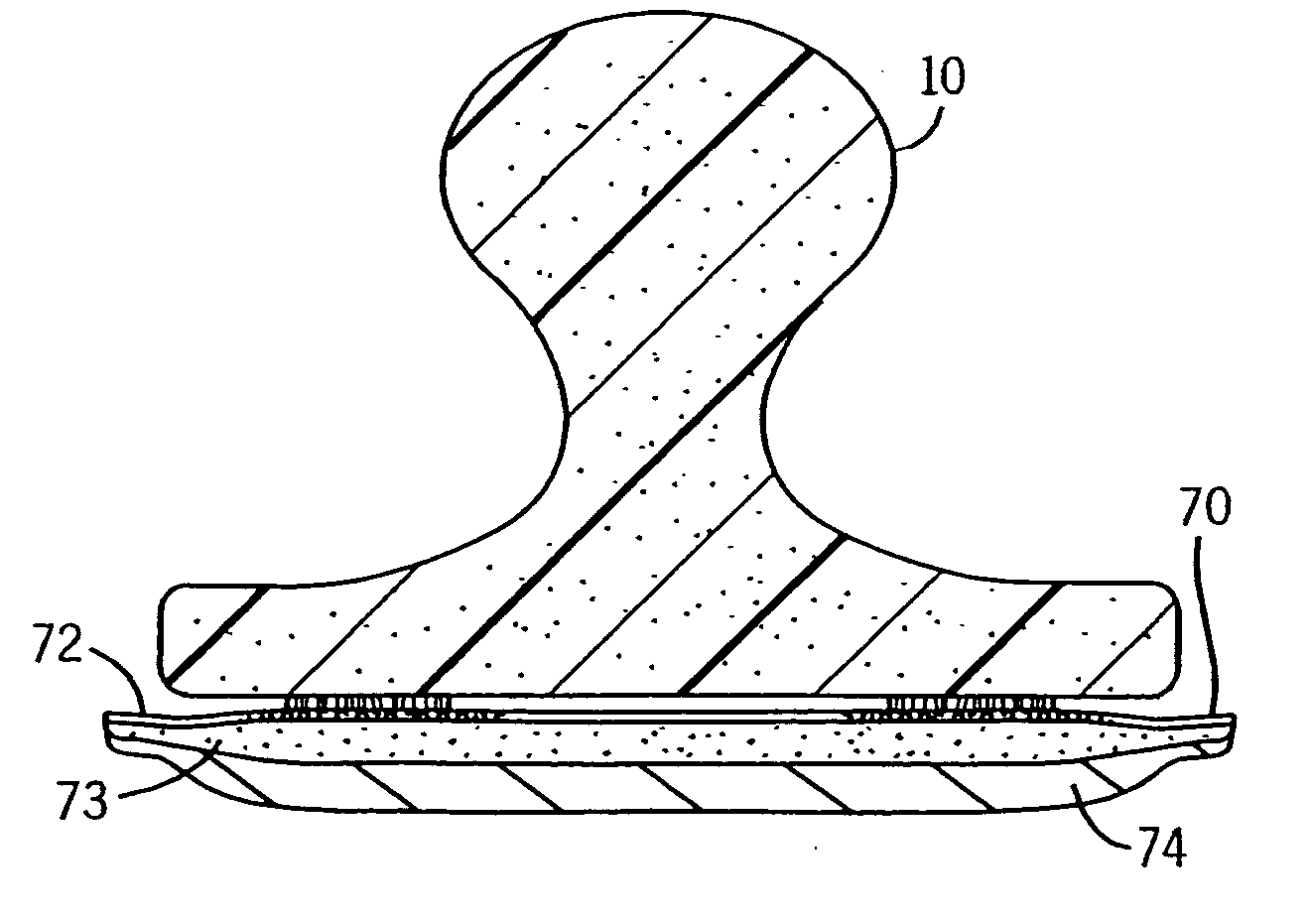 Cleaning system