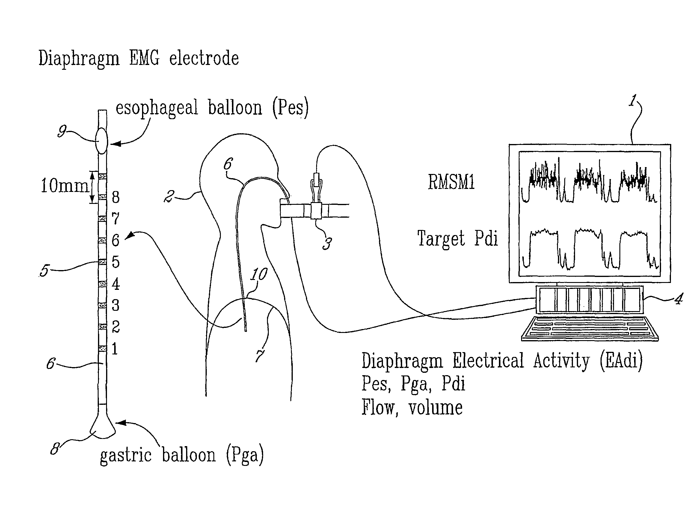 Method and device using myoelectrical activity for optimizing a patient's ventilatory assist