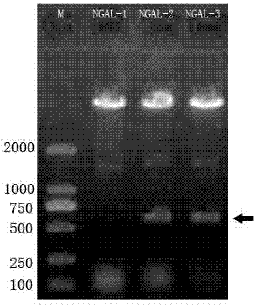 B cell epitope peptide of human neutrophil gelatinase associated lipocalin and application thereof