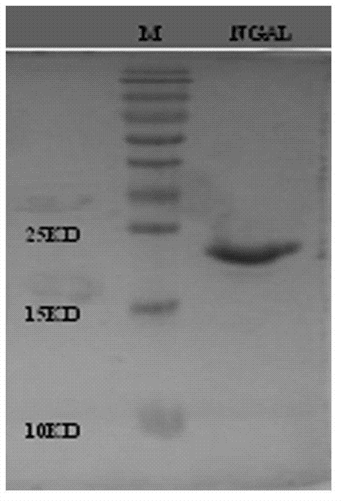 B cell epitope peptide of human neutrophil gelatinase associated lipocalin and application thereof