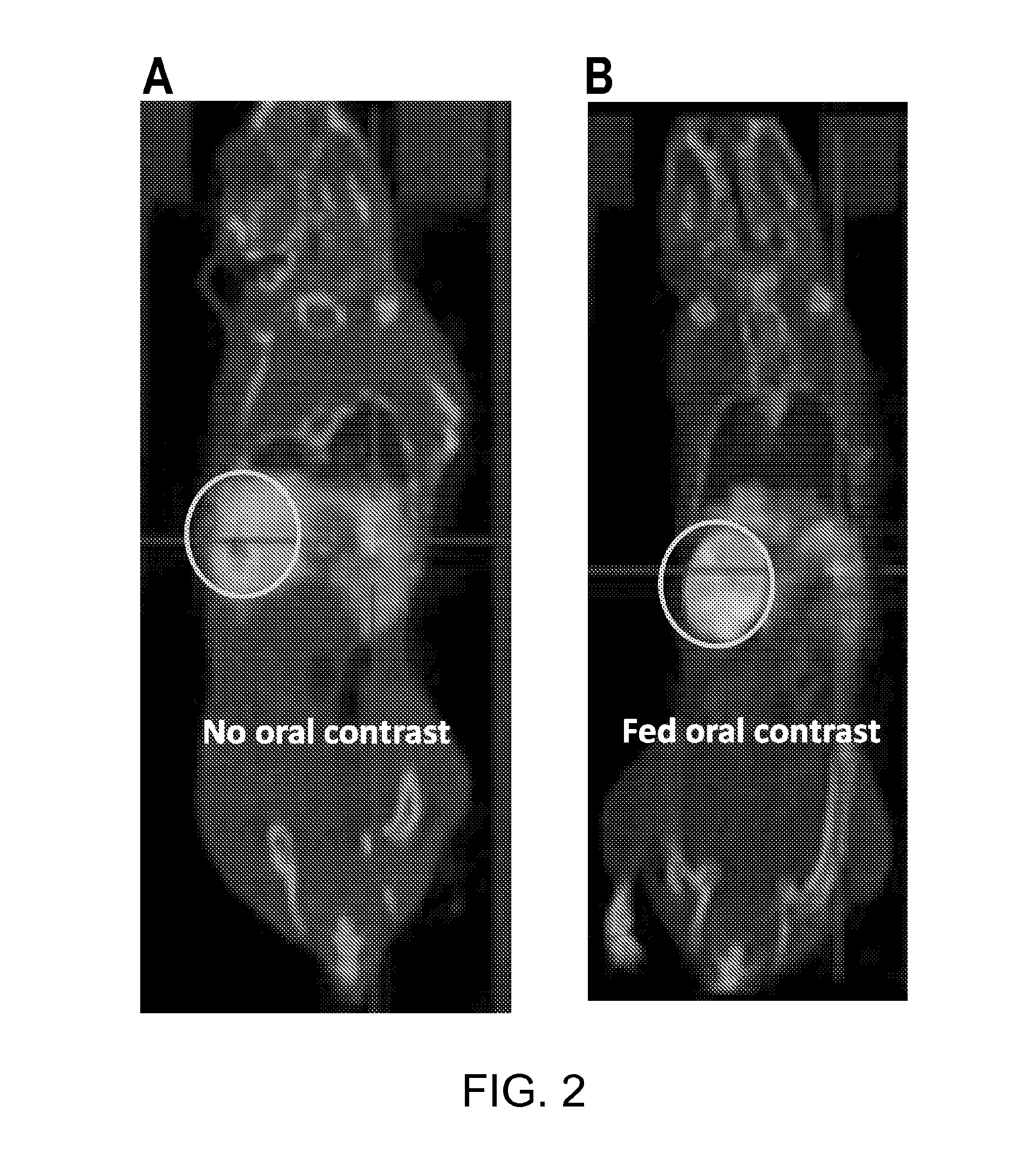 Radiotracer imaging using sodium iodide symporter polypeptides