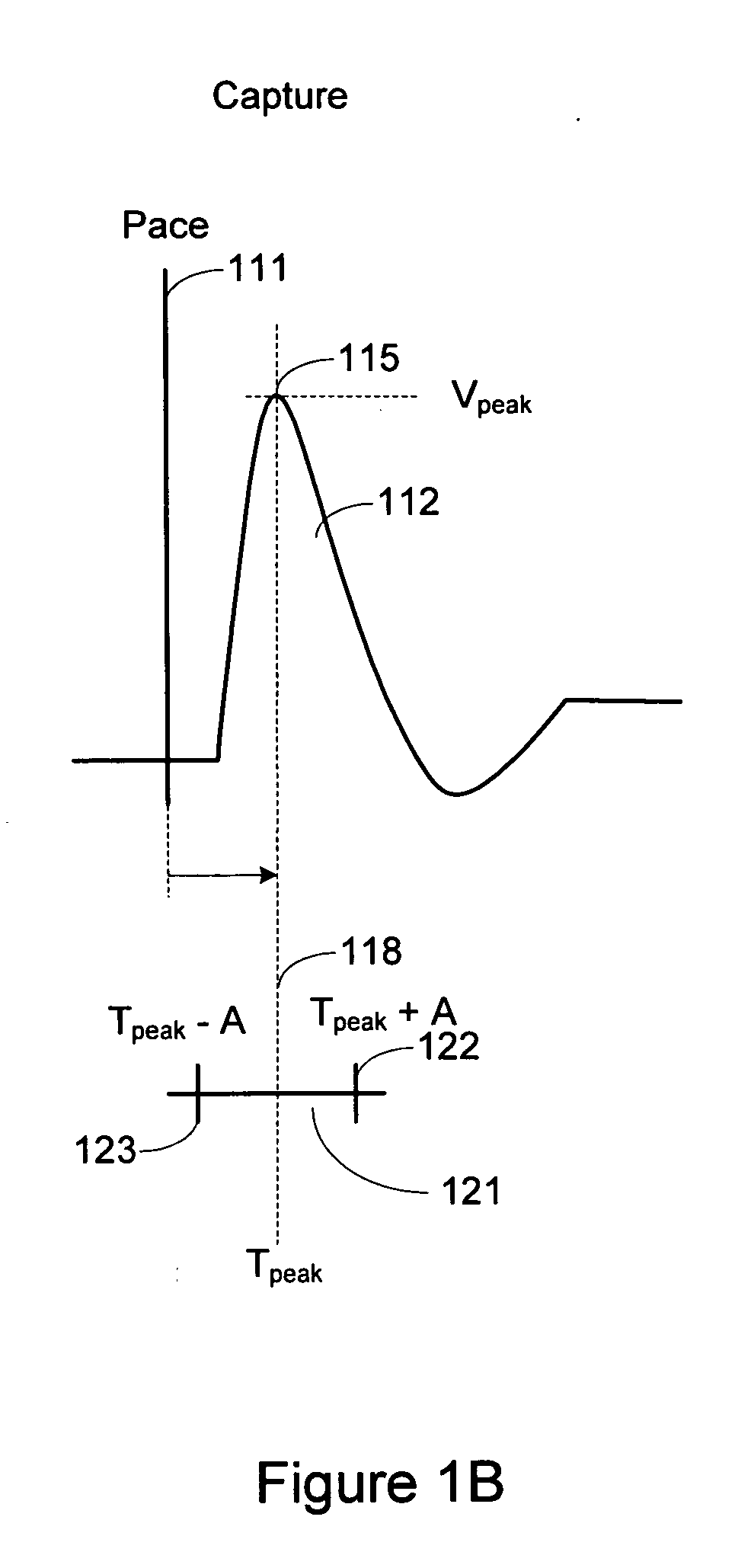 Cardiac pacing response classification based on waveform feature variability