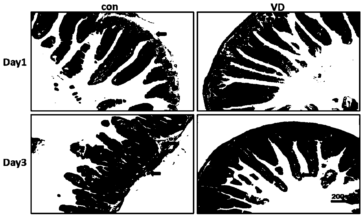 Application of vitamin D in prevention and treatment of intestinal injury caused by radiation