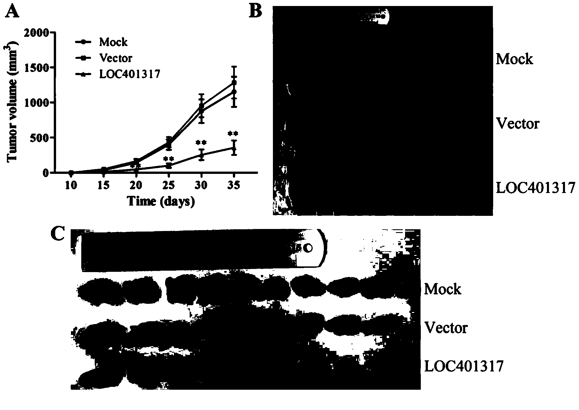 Expression vector and anti-tumor reagent of long-chain non-coded RNALOC401317, and applications of expression vector and anti-tumor reagent