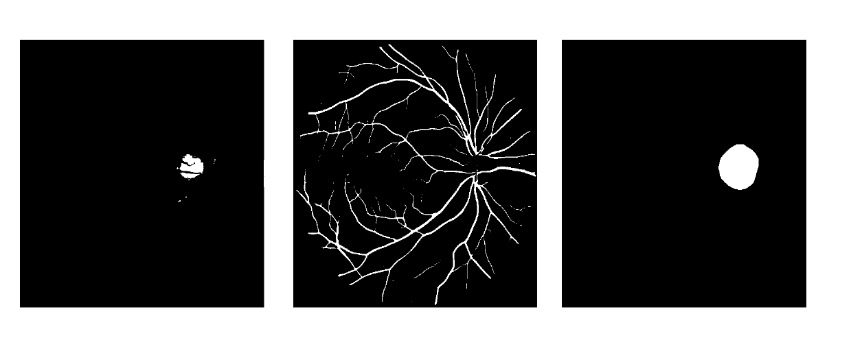 Retina vessel curvature determination method