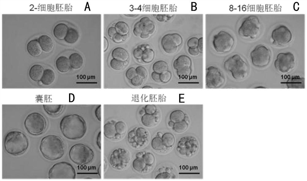 Application of New Wenshen Shengjing Decoction (NWSSJD) as medicine for regulating expression level of H3K4me3