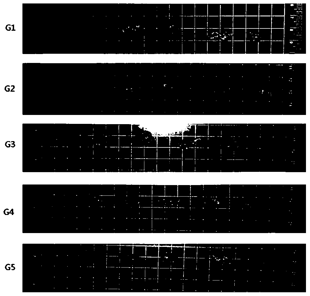 Application of metabolic biomarkers in acute pancreatitis