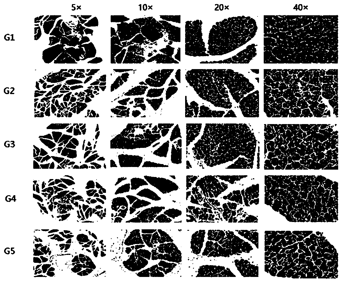 Application of metabolic biomarkers in acute pancreatitis