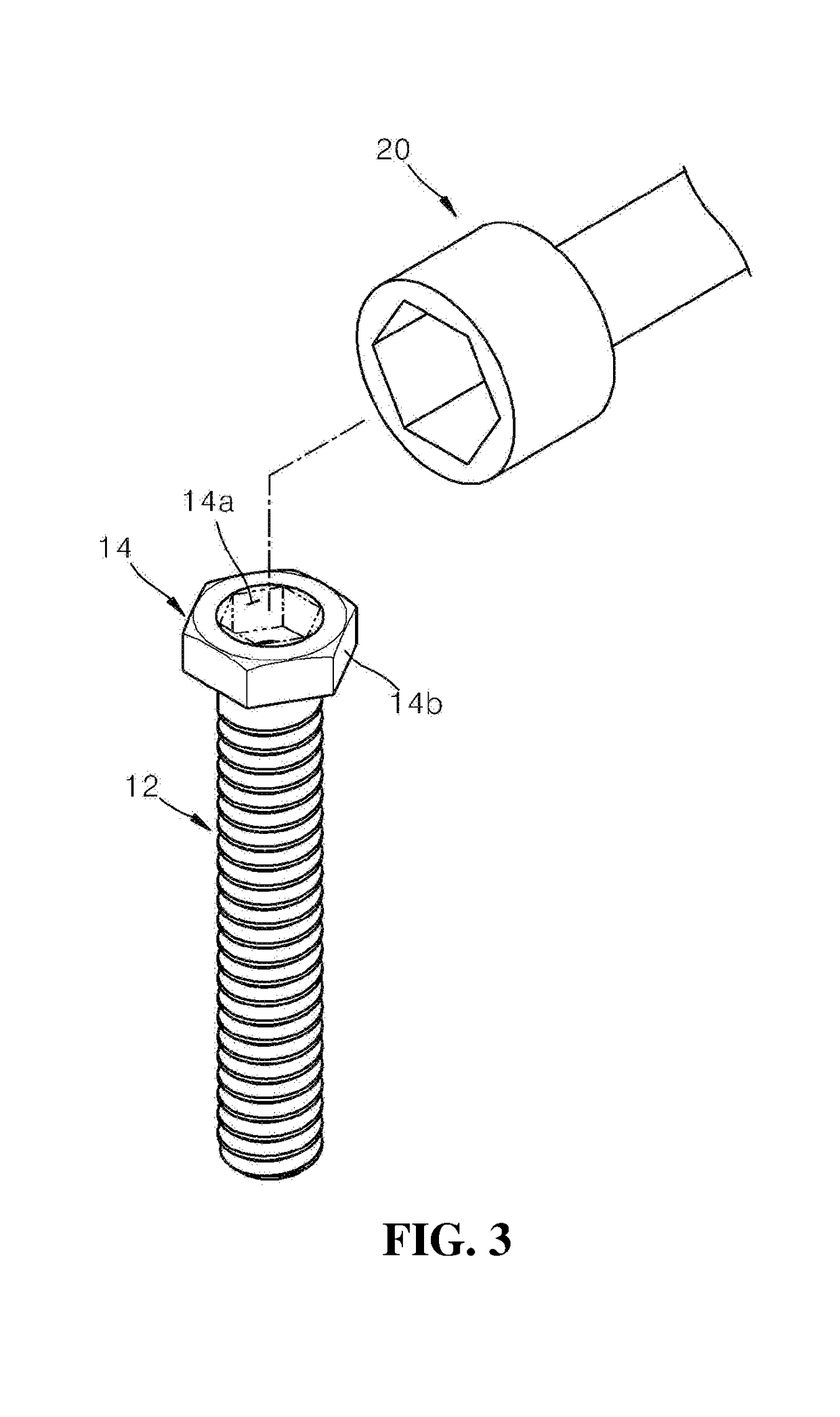 Human bone treatment unit