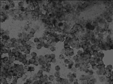 MicroRNA-155 level in various types of cancerous lesions prophase in situ hybridization detection kit, detection method and application thereof