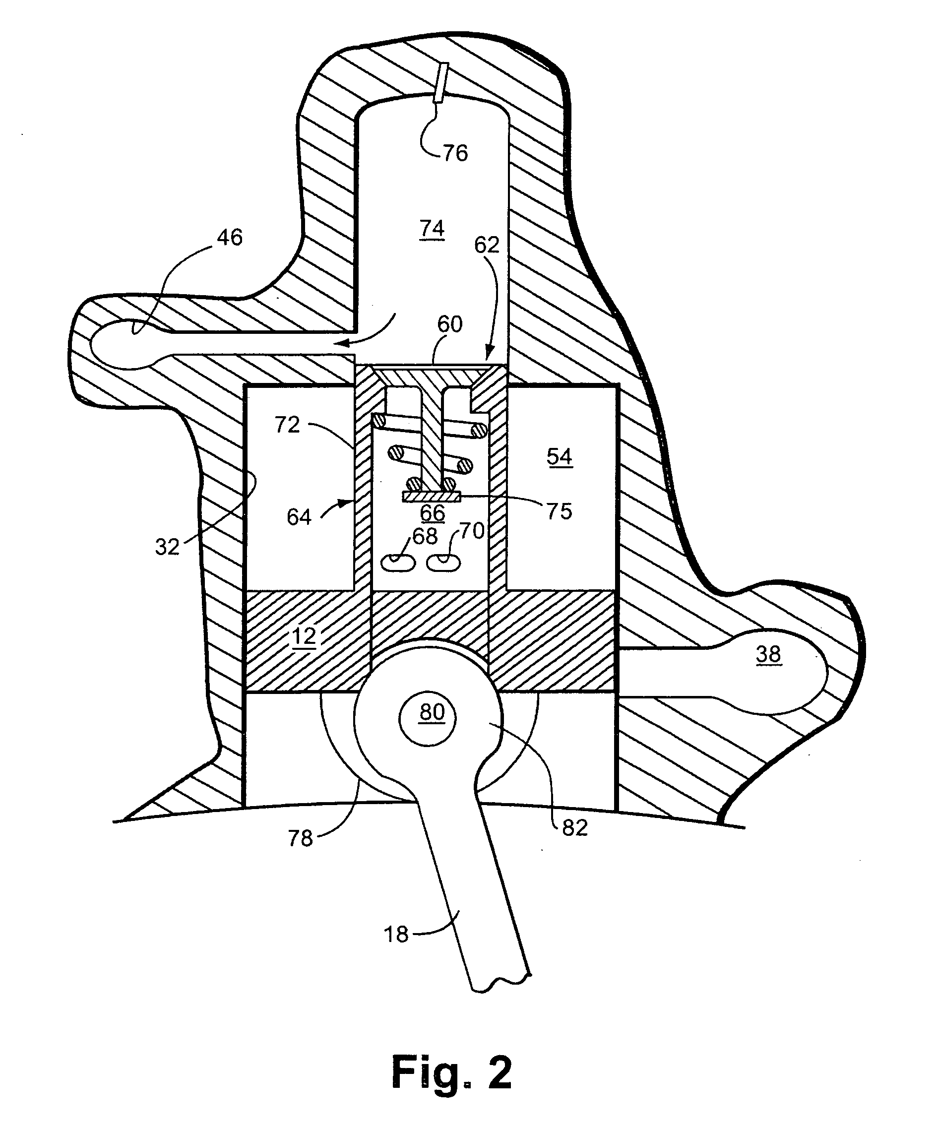 Radial engine power system