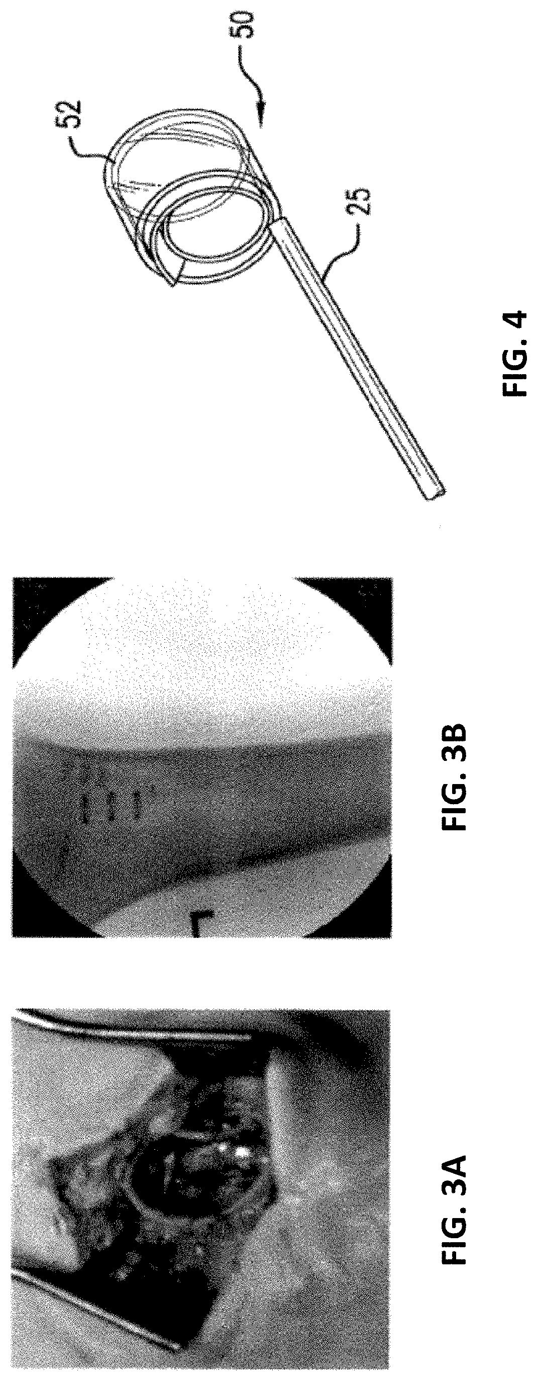 Nerve cuff electrode for neuromodulation in large human nerve trunks