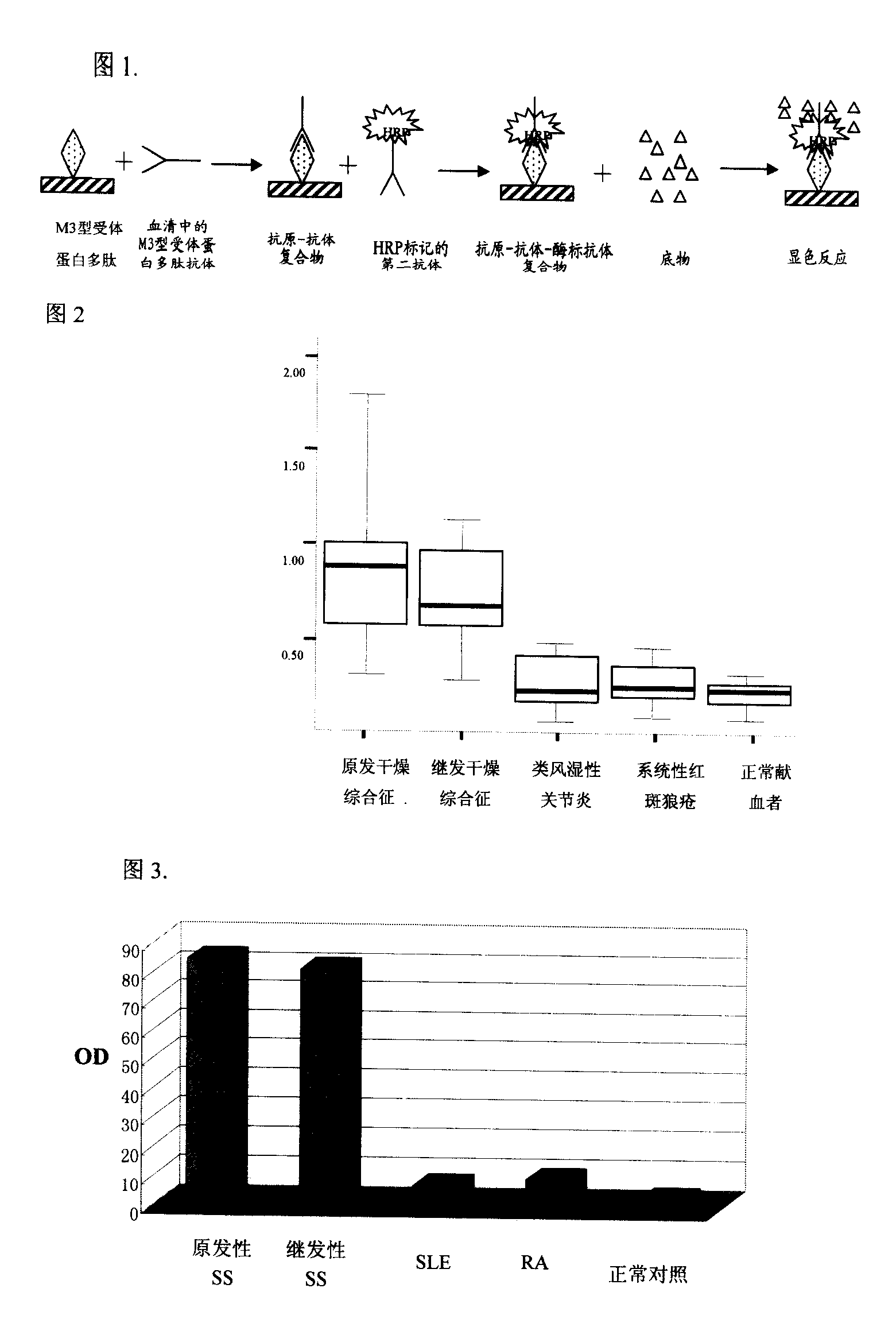 Application of M3 type receptor protein polypeptide resisting antibody measurement in Sjogren syndrome diagnosis