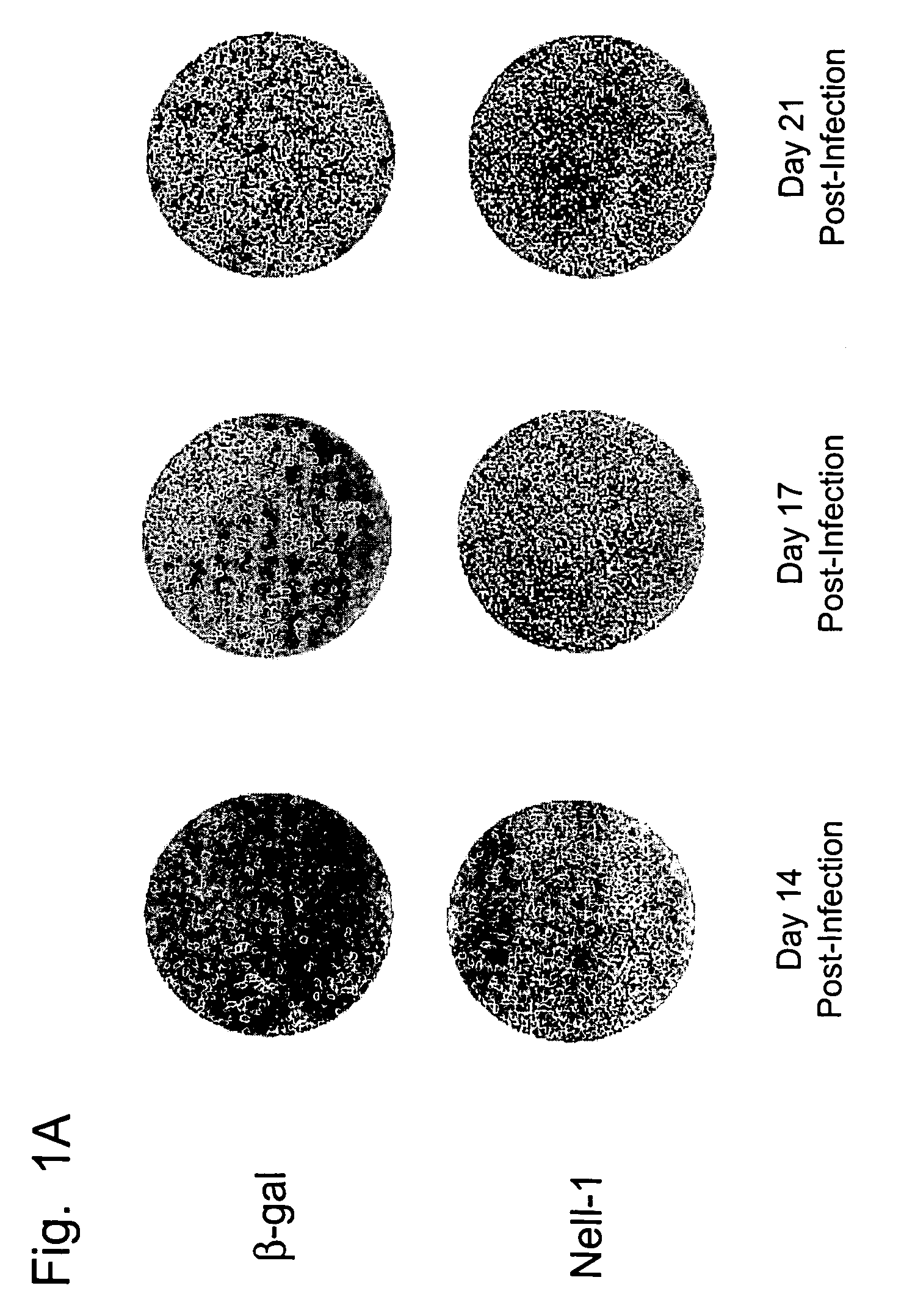 NELL-1 enhanced bone mineralization