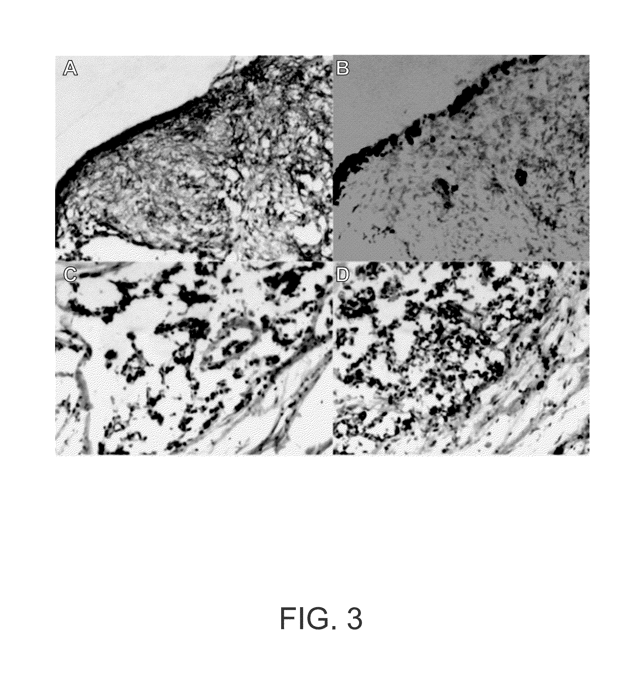 Hoxc6 and ovarian cancer methods and uses thereof