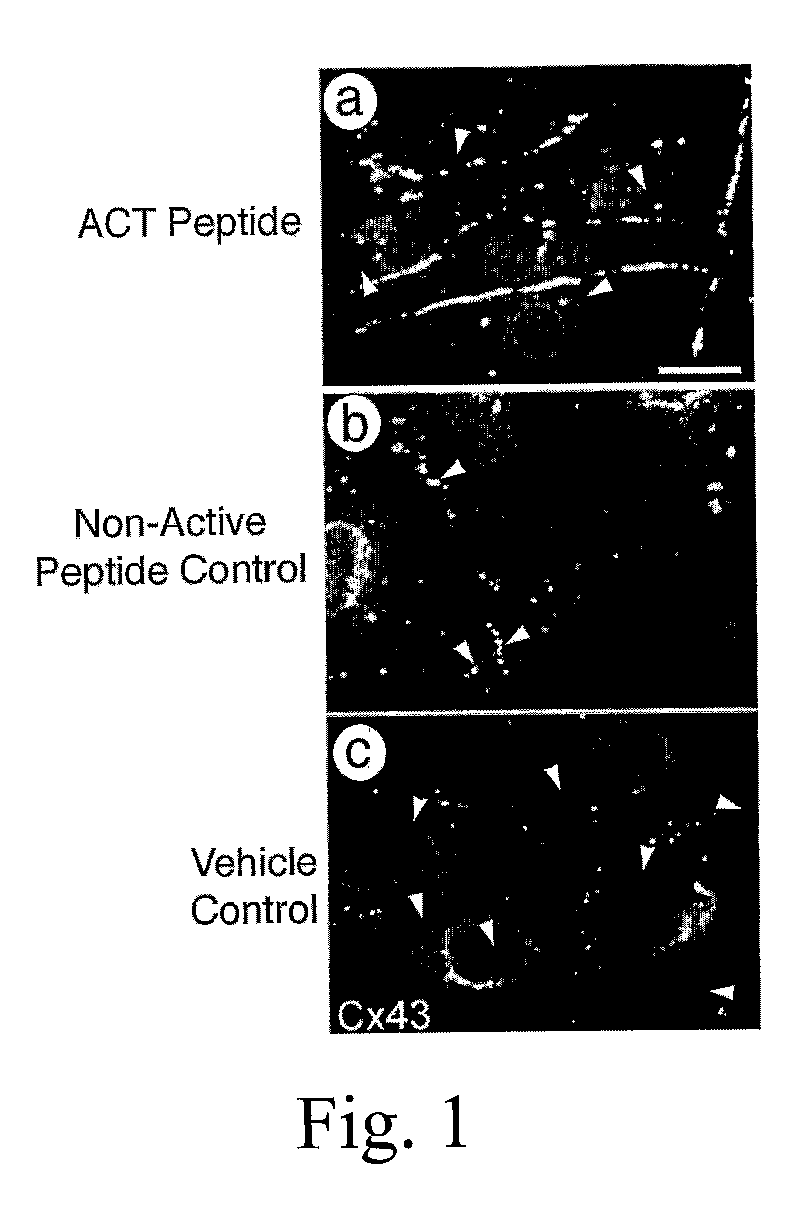 Composition and Methods for Promoting Wound Healing and tissue Regeneration