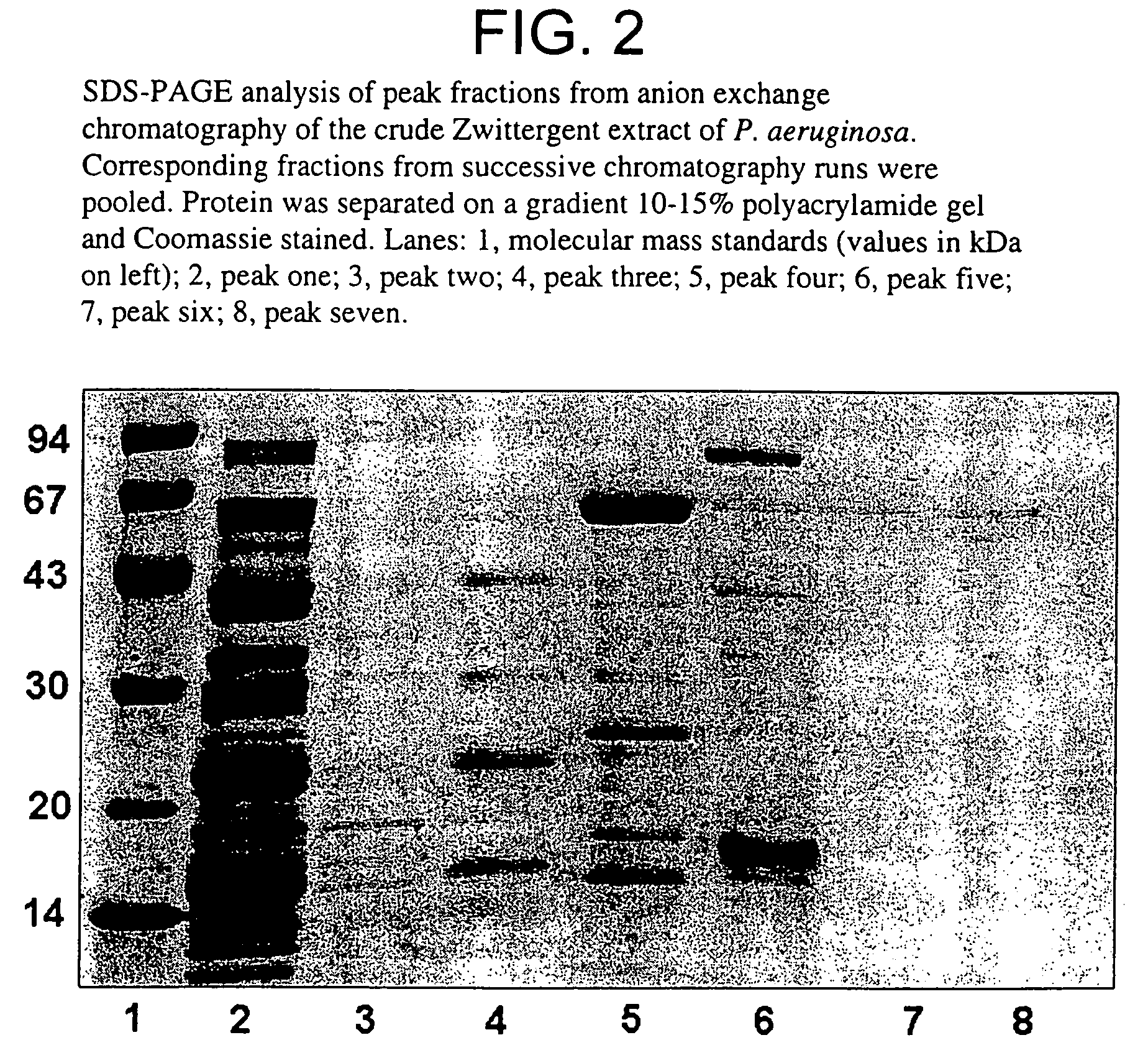 Pseudomonas aeruginosa antigens