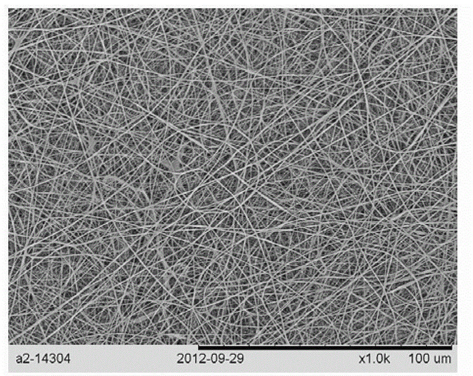 Preparation method for protein-polyose-polylactic acid polycaprolactone vascular stent