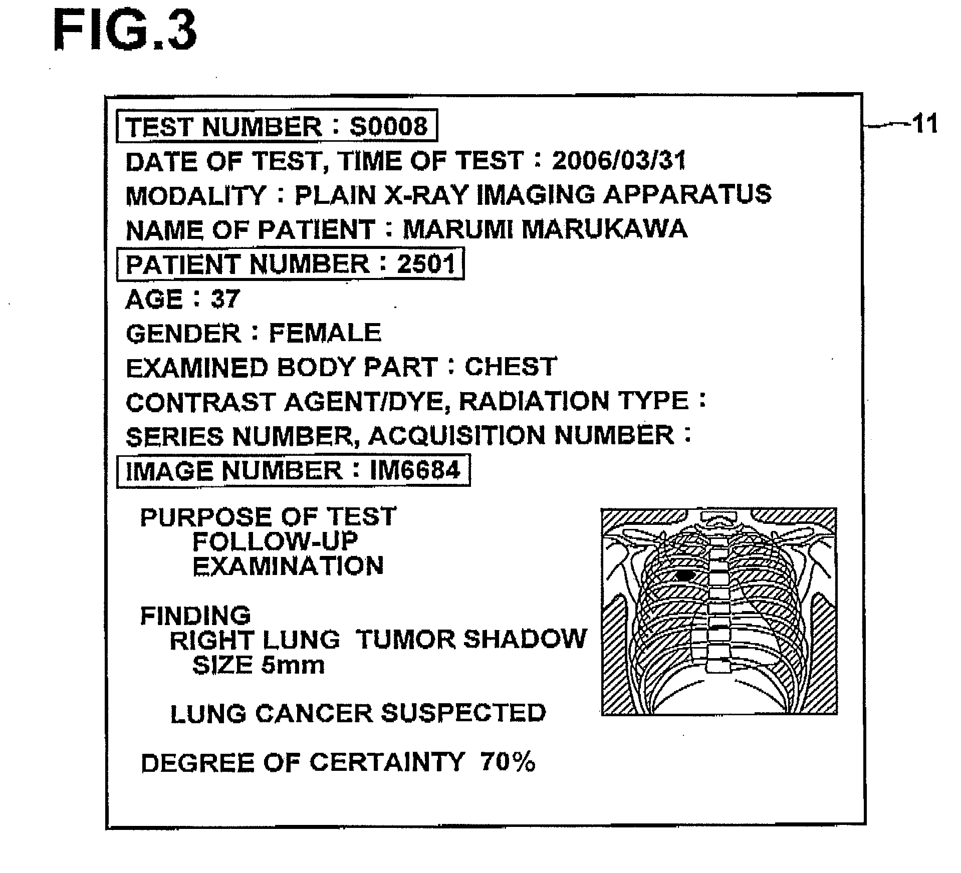 Diagnosis support system