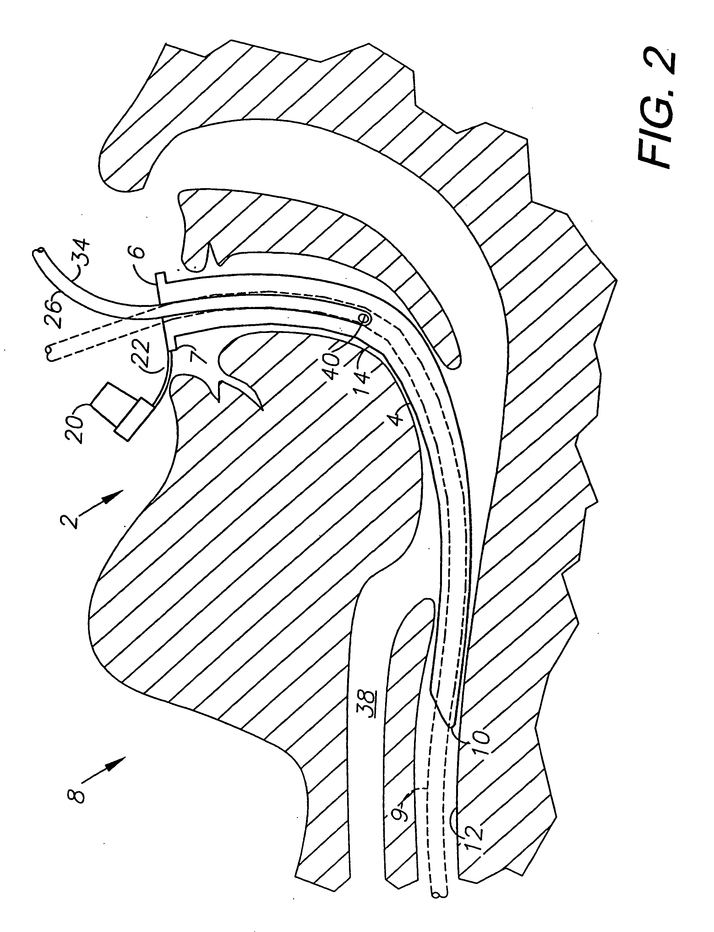 Esophageal intubation and airway management system and method