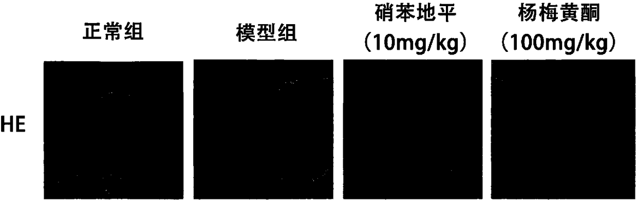 Total flavonoids from waxberry, preparation method and application of total flavonoids from waxberry, and eNOS agonist