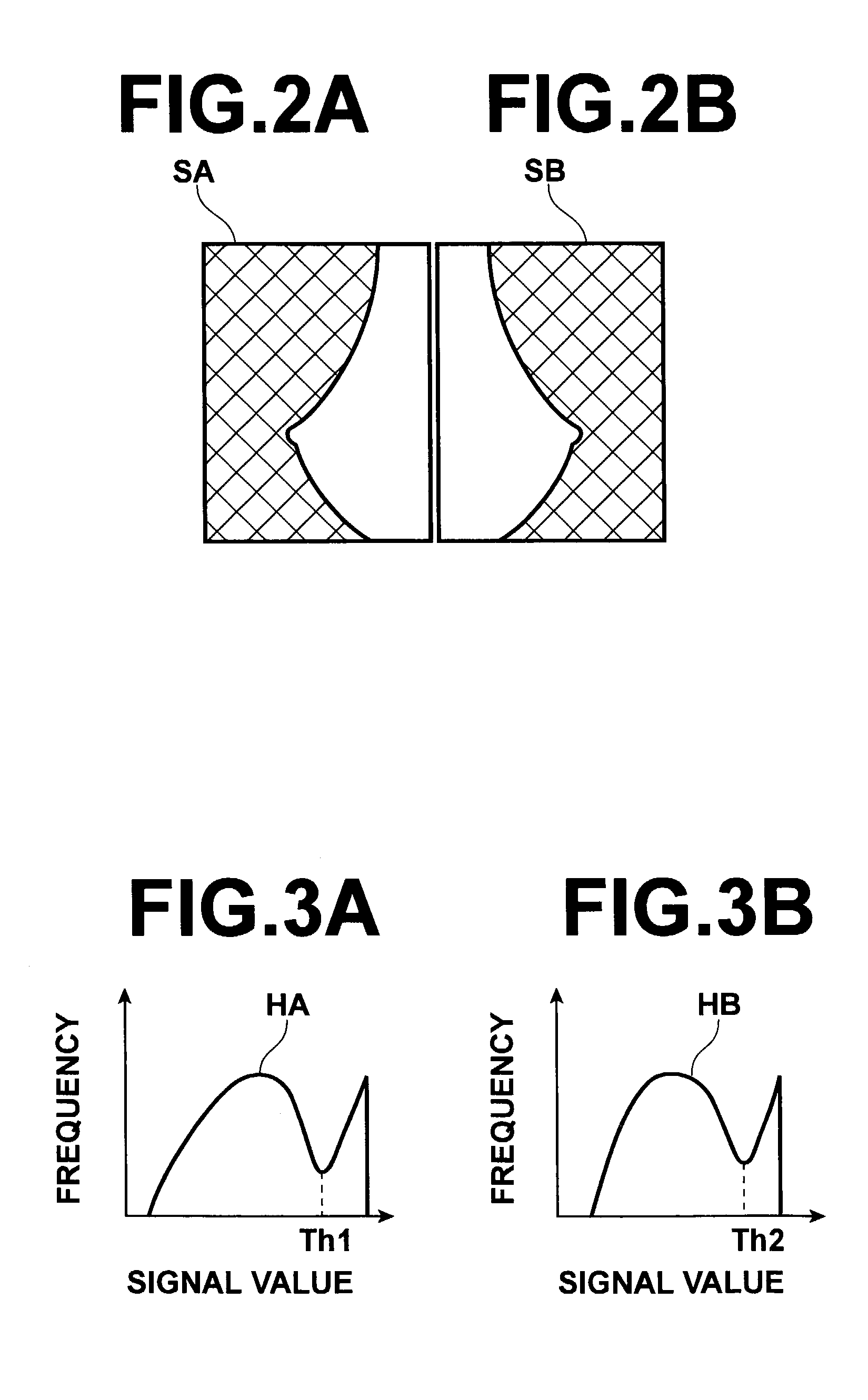 Abnormal shadow detecting system