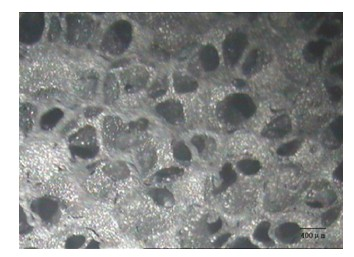 Preparation method of porous tantalum as medical metal implant material