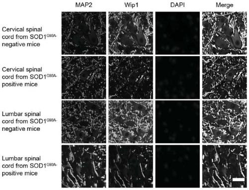 Wip1 gene and purpose of its expressed protein in treatment of amyotrophic lateral sclerosis