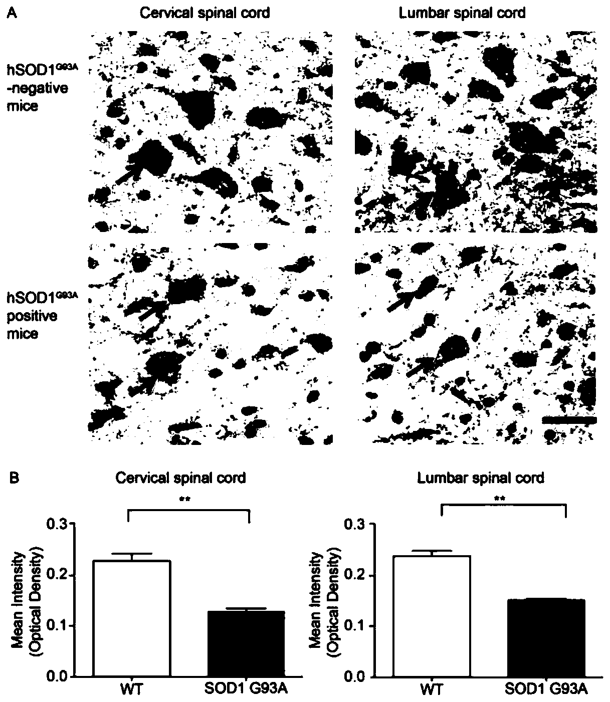 Wip1 gene and purpose of its expressed protein in treatment of amyotrophic lateral sclerosis