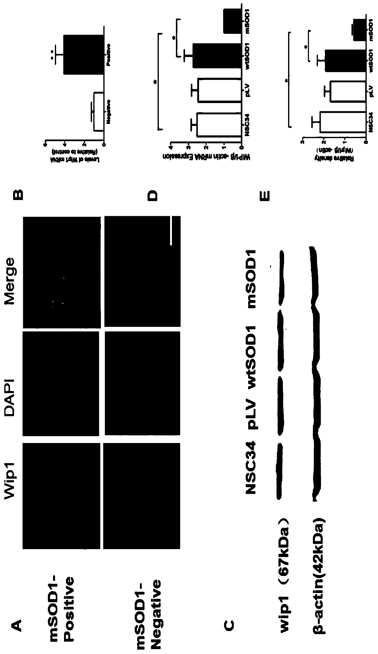 Wip1 gene and purpose of its expressed protein in treatment of amyotrophic lateral sclerosis