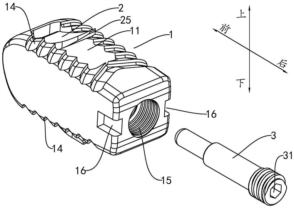 Interbody fusion cage