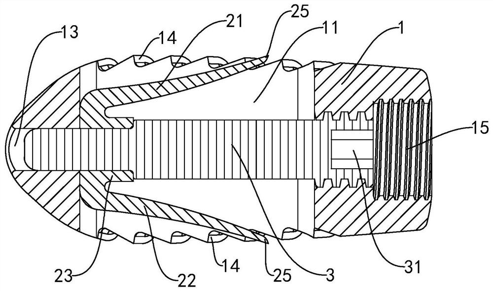 Interbody fusion cage