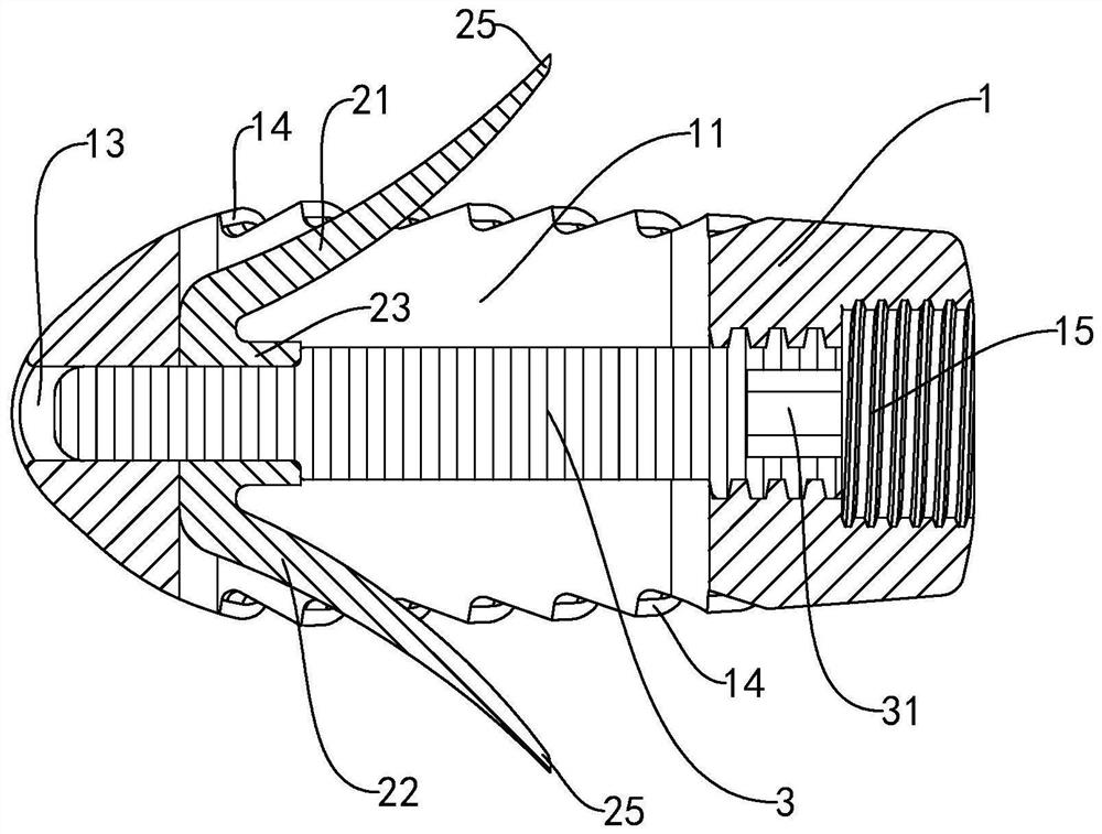 Interbody fusion cage