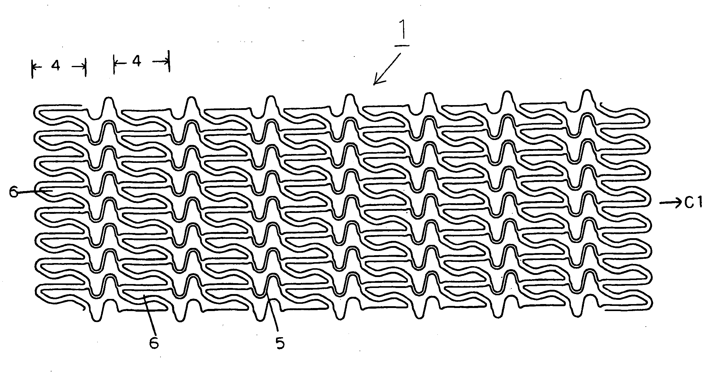 Stent