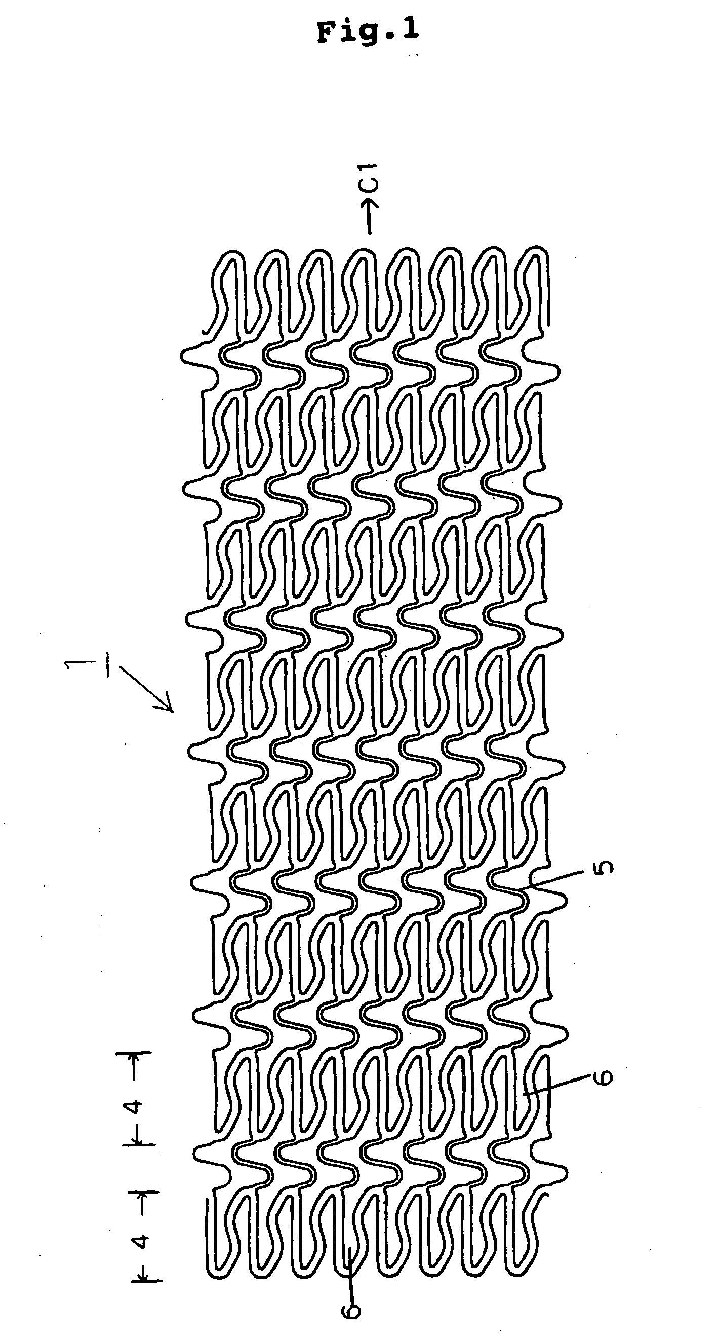 Stent