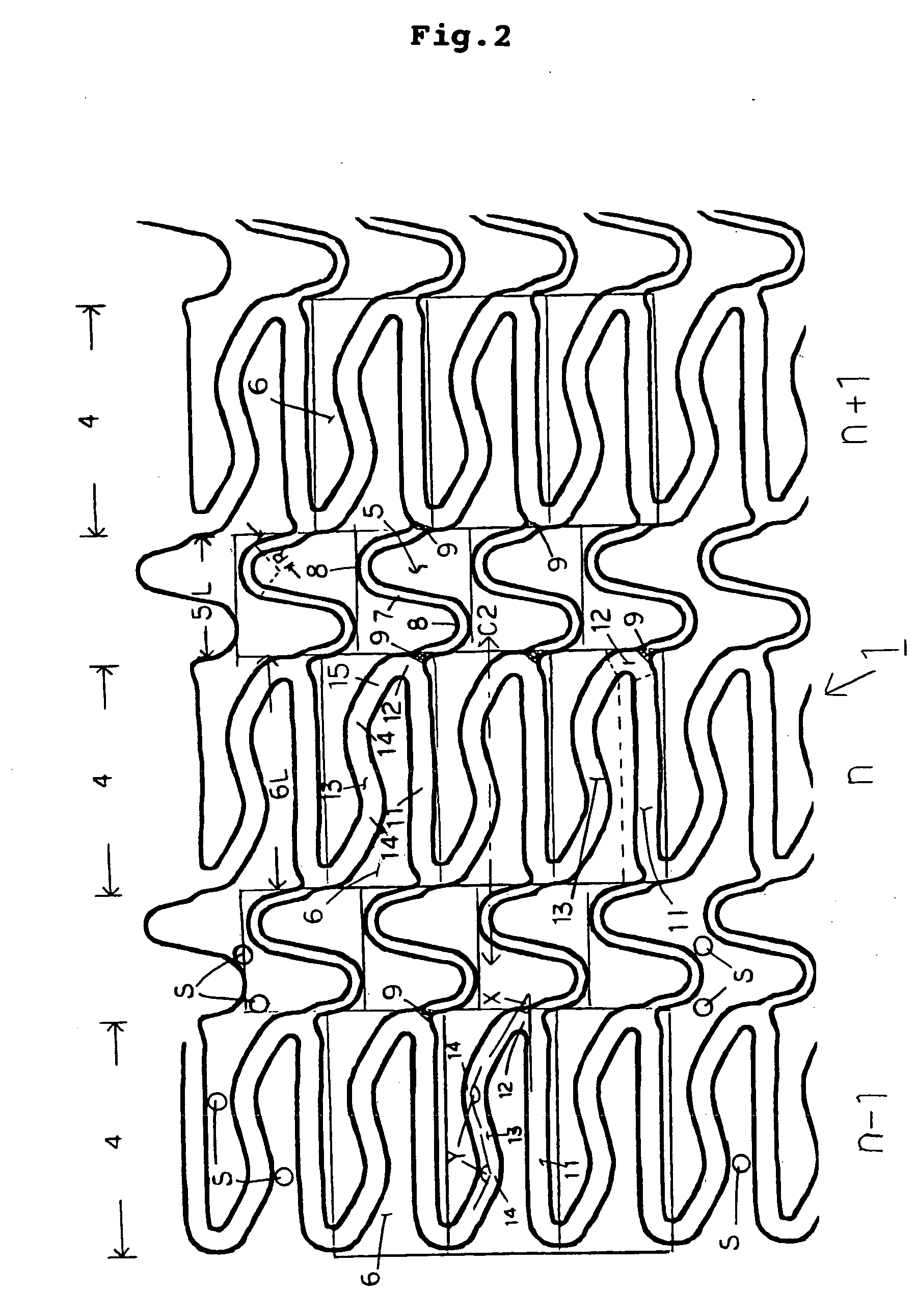 Stent