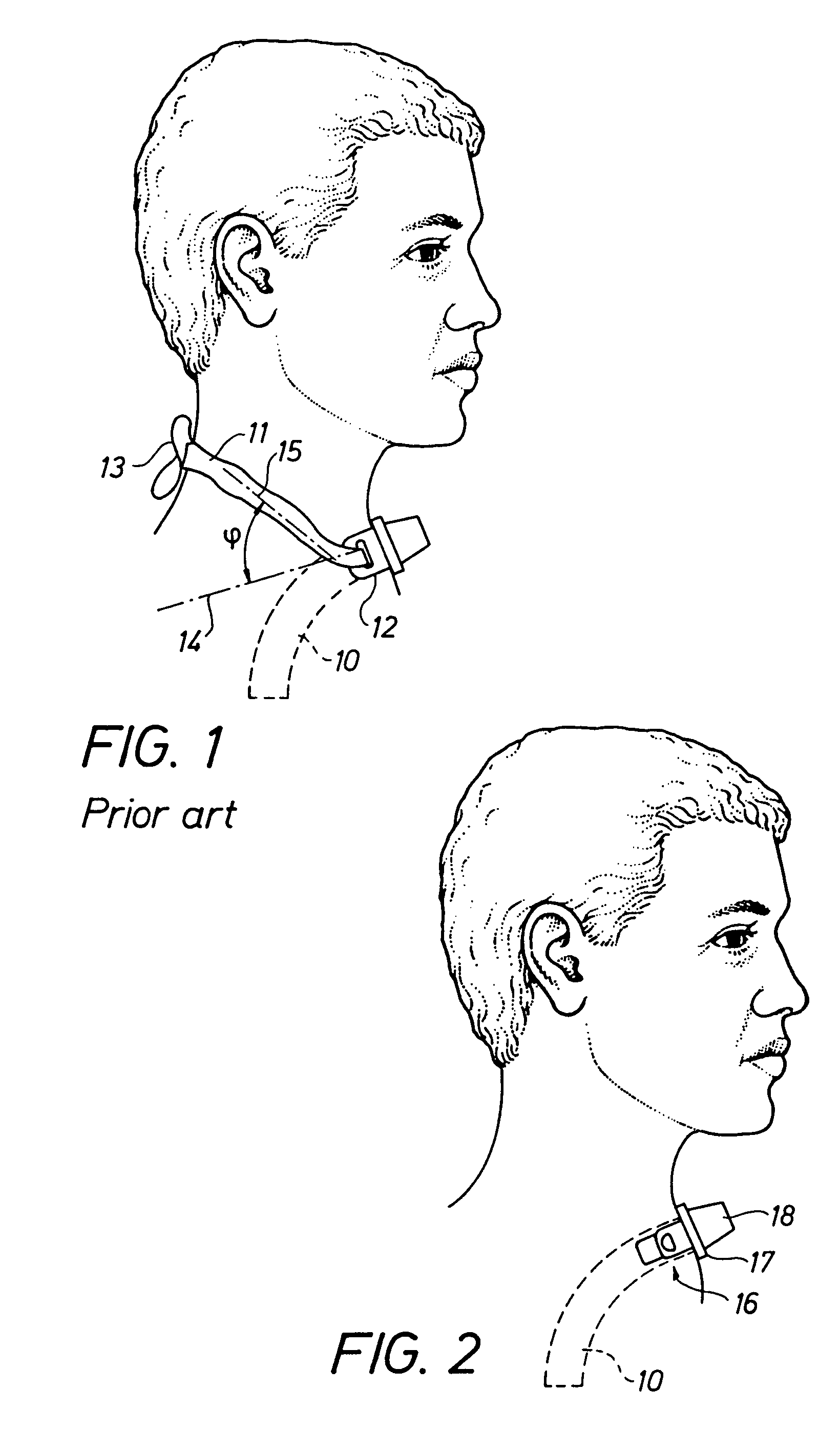 Device for holding a tracheal cannula