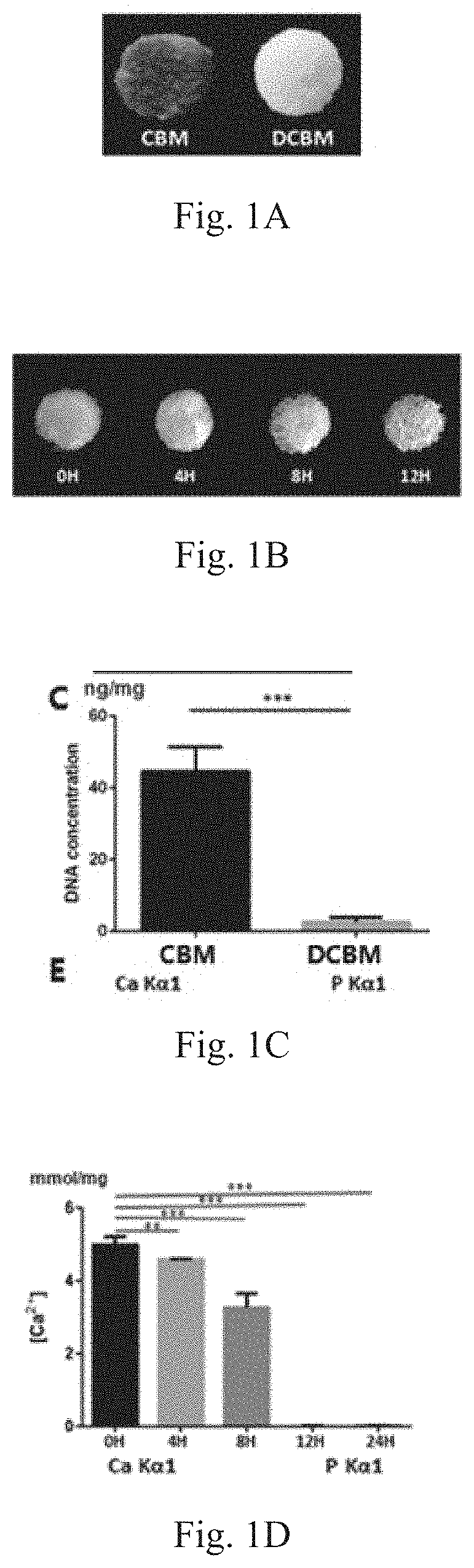 Preparation method of gradient mineralized cancellous bone matrix material