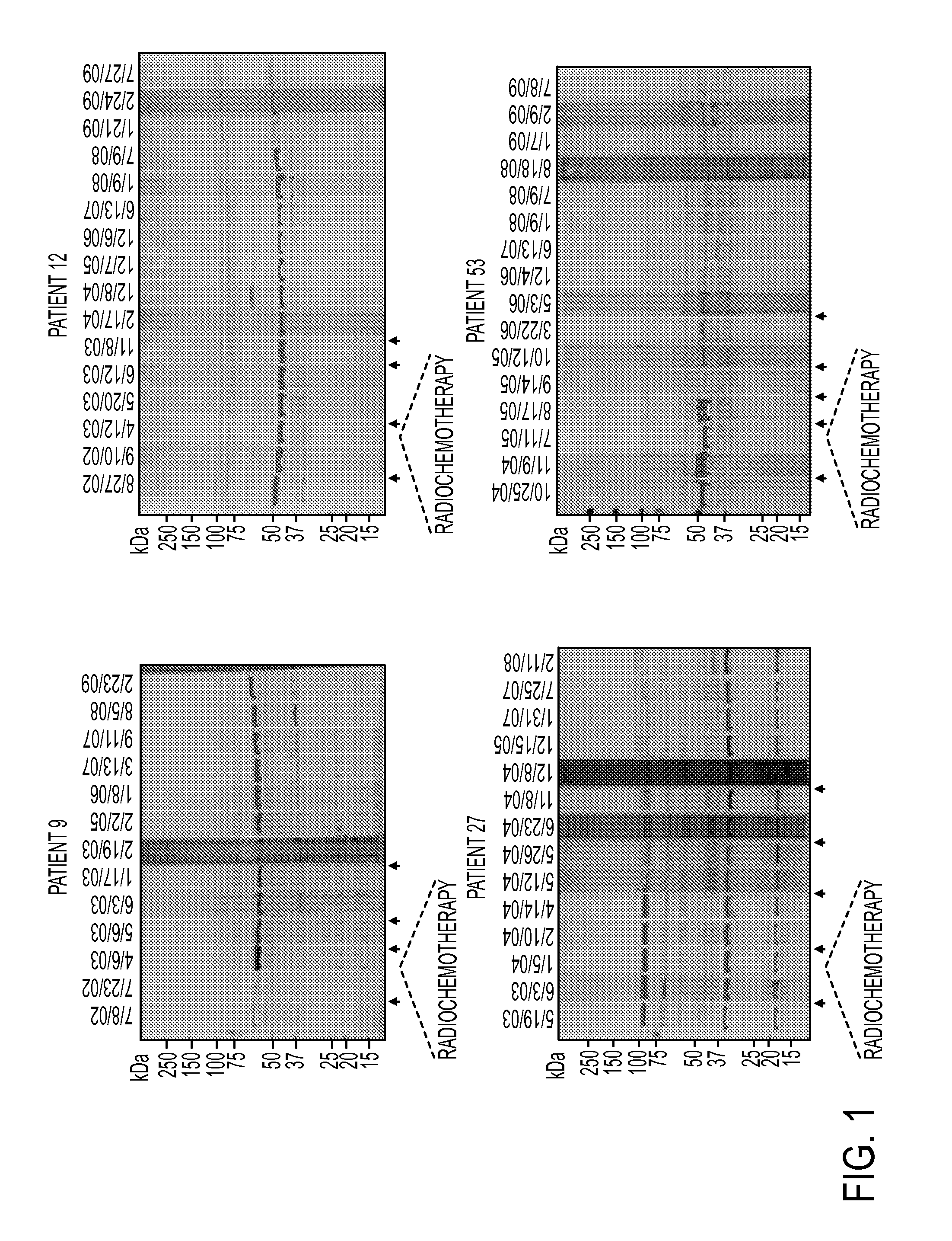 Annexin a2 as immunological target