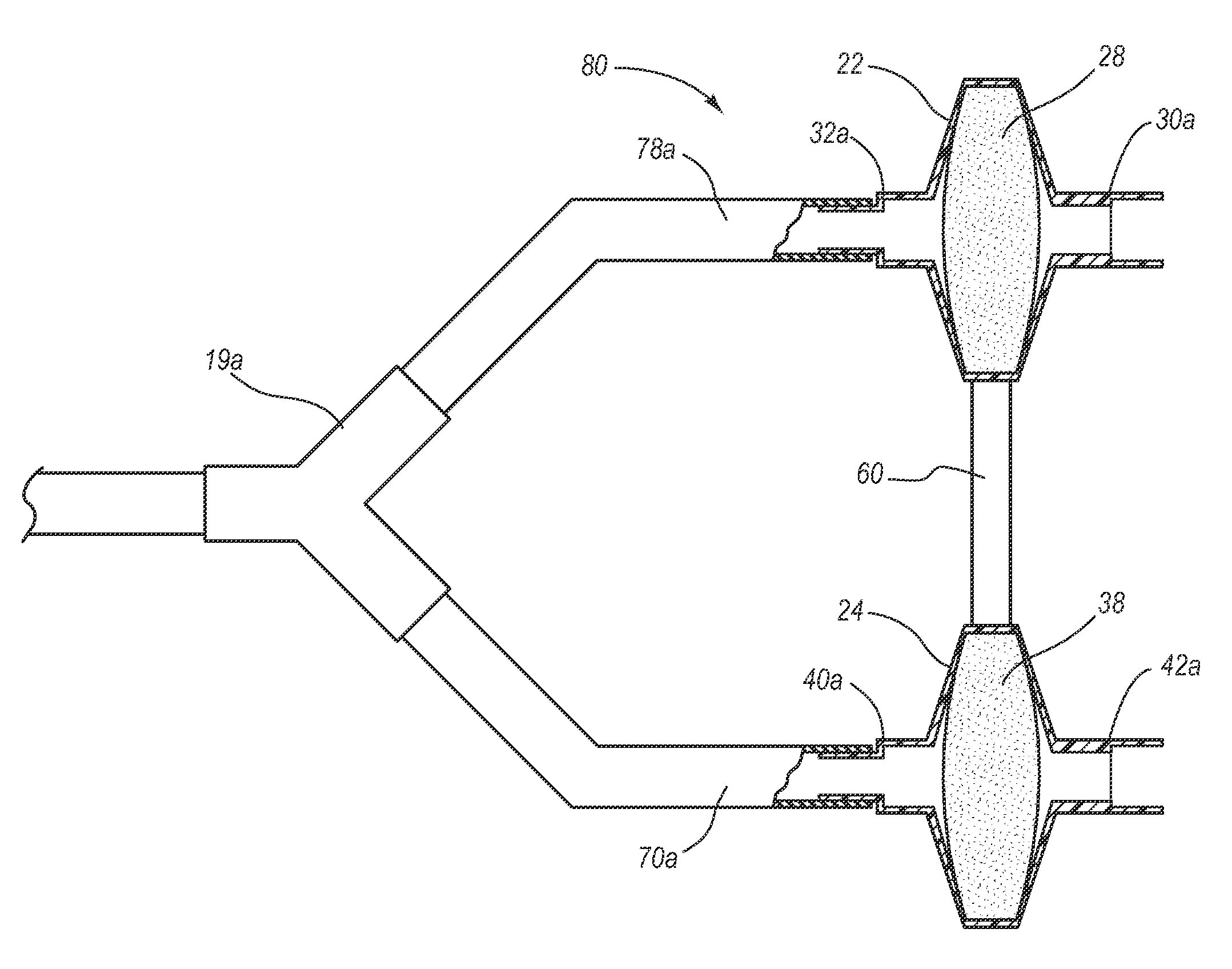 System, method and apparatus for removal of volatile anesthetics for malignant hyperthermia