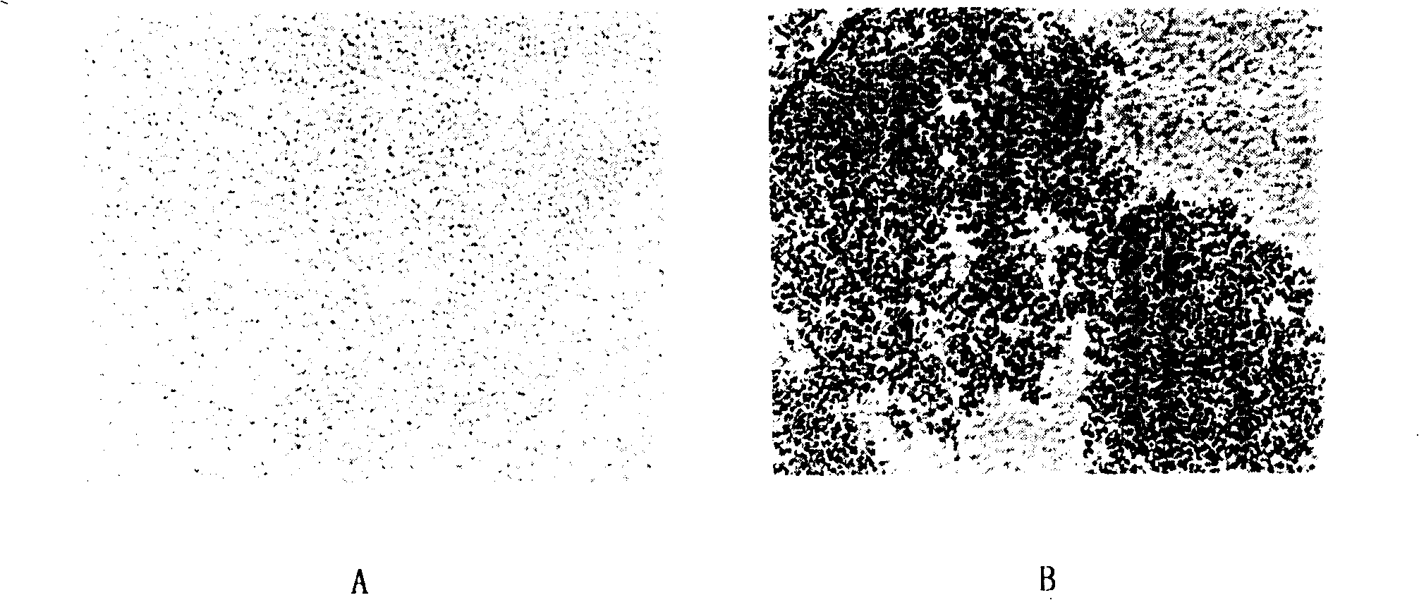 Immunization microsphere in use for detecting SARS antibody, preparation method and application