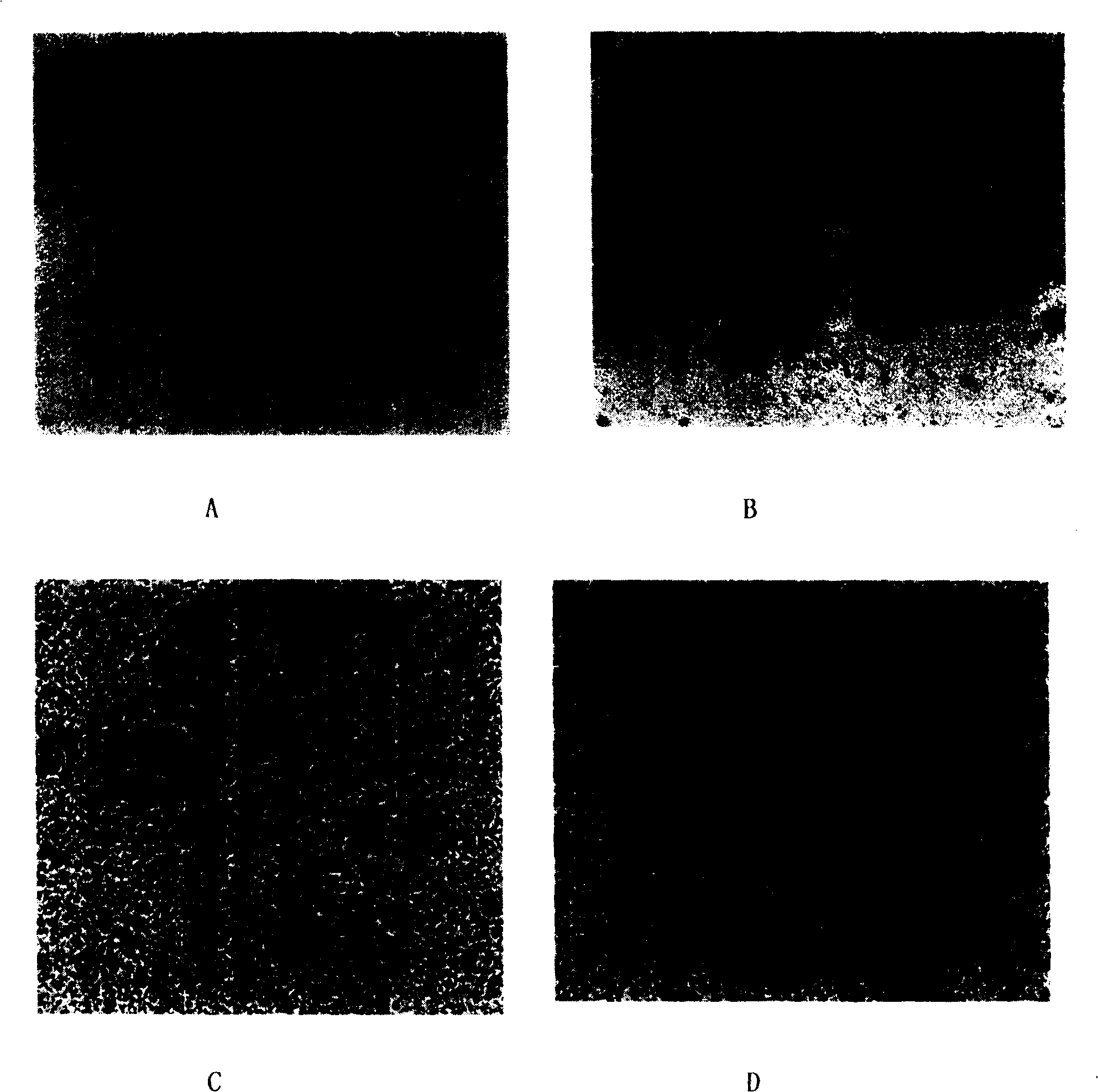 Immunization microsphere in use for detecting SARS antibody, preparation method and application