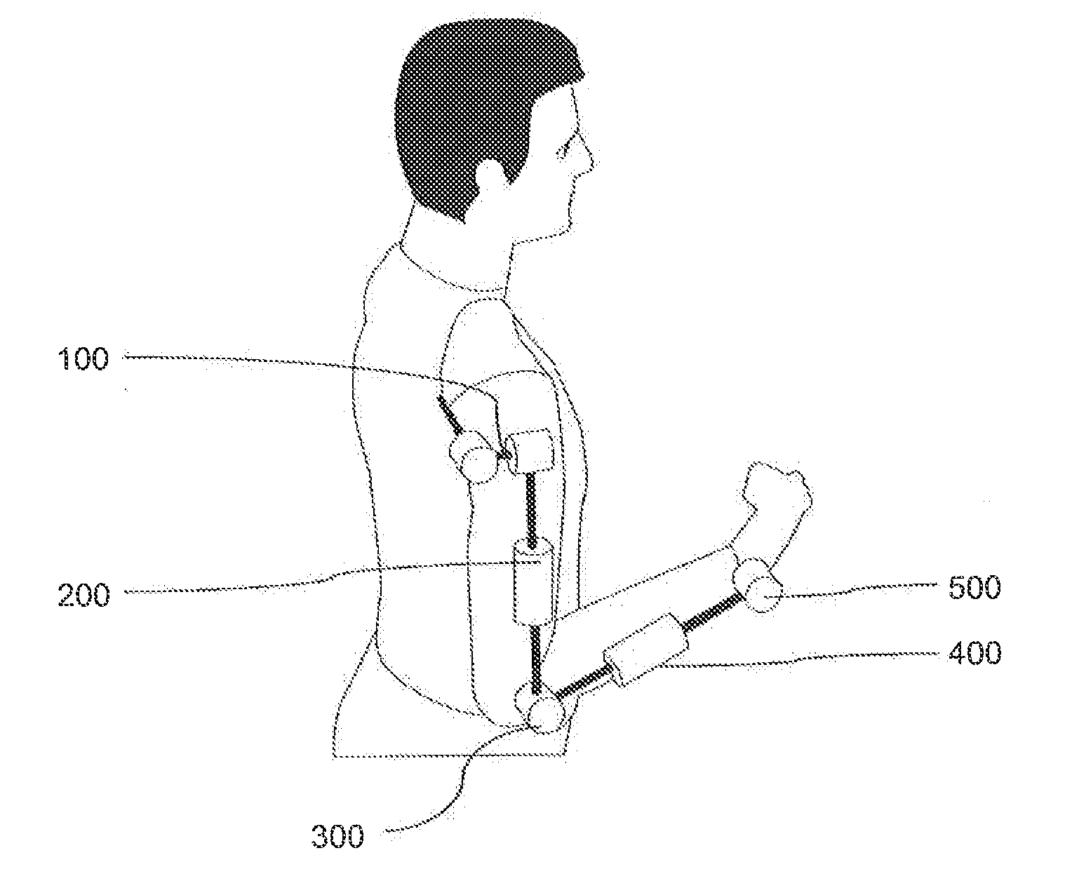 Rehabilitation Robot