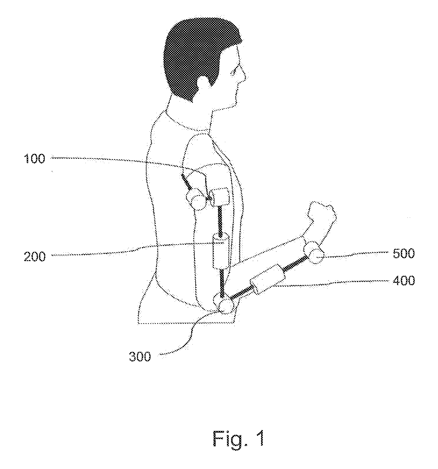 Rehabilitation Robot