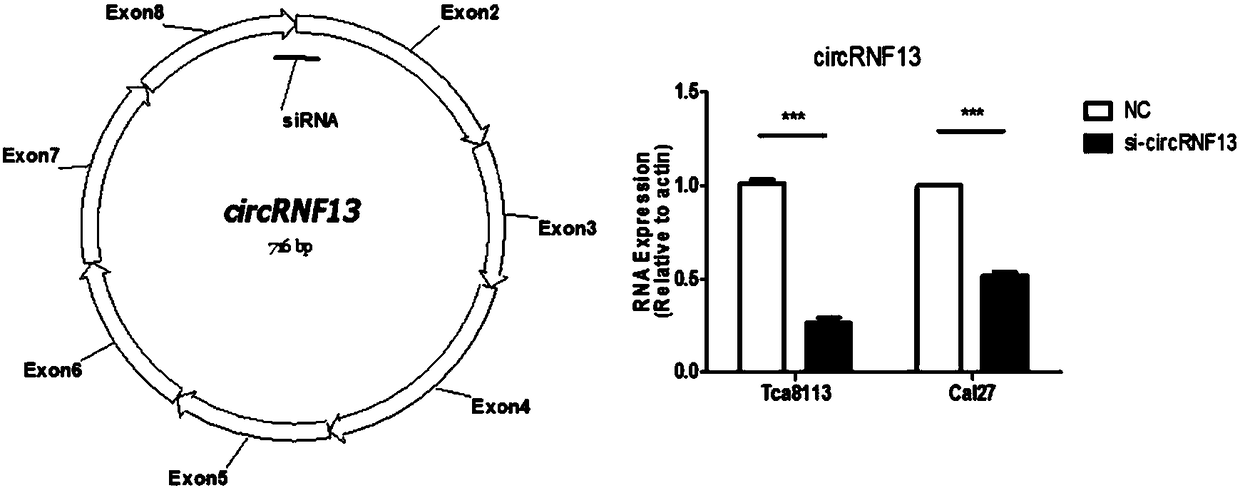 Application of reagent for detecting ring-shaped RNA (ribonucleic acid) circRNF13 in preparing tongue squamous carcinoma auxiliary diagnosis preparation