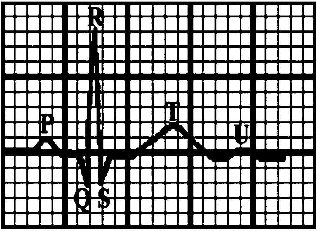 Electrocardio monitoring method, device and terminal and computer-readable storage medium